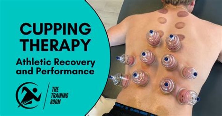 Can physical therapists perform cupping?