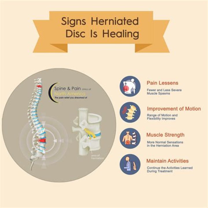 Can you herniate your sacrum?