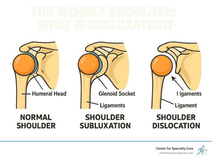 How do you fix a Subluxed jaw?