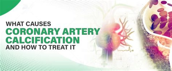 How do you treat calcification?