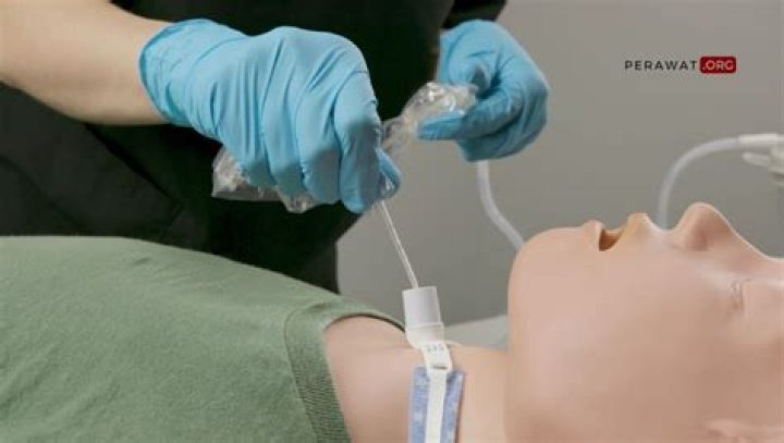 How do you use a DeLee suction catheter?
