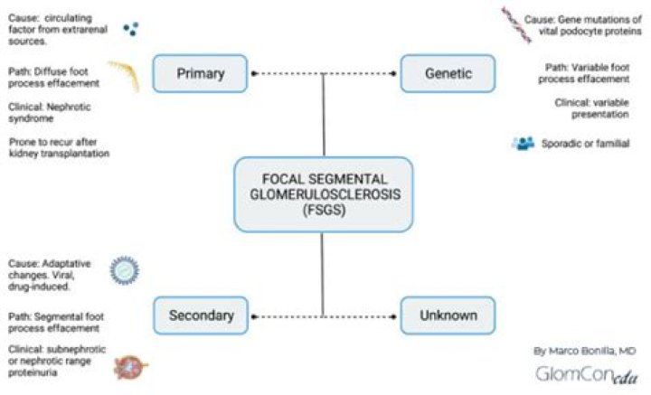 Is FSGS an autoimmune disease?