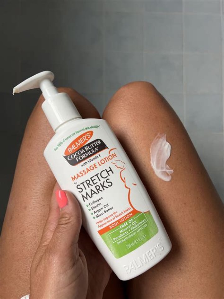 Is snake oil good for stretch marks?