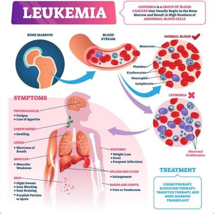 What foods can prevent leukemia?