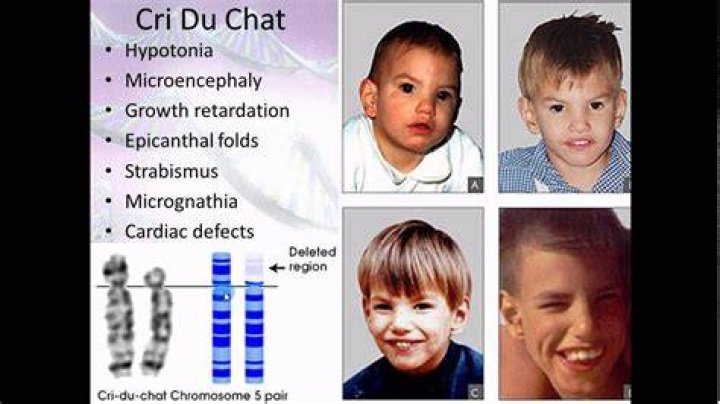 What happens if you have 44 chromosomes?