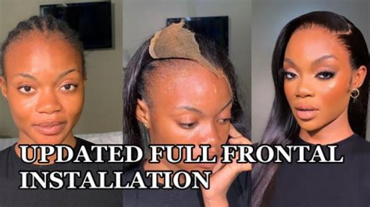 What is a frontal install?