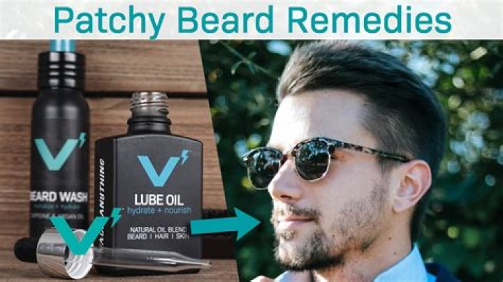 What is a natural remedy for patchy beard?