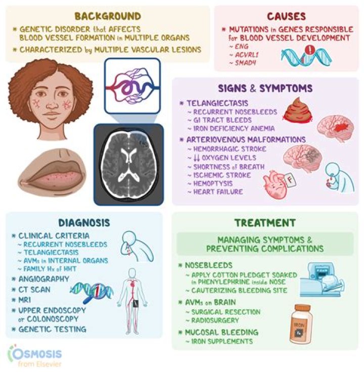 What is Periungual telangiectasia? | ContextResponse.com