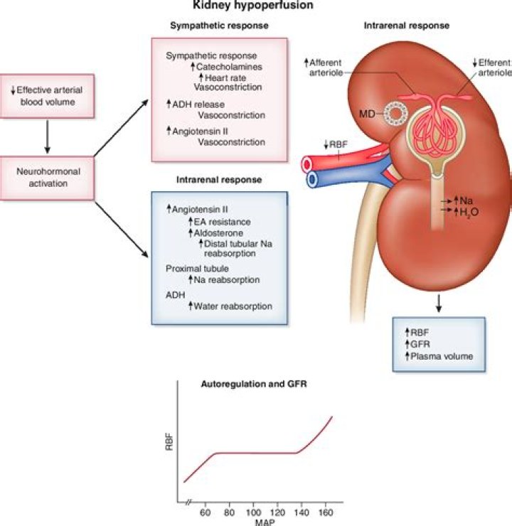 What is Prerenal azotemia? | ContextResponse.com
