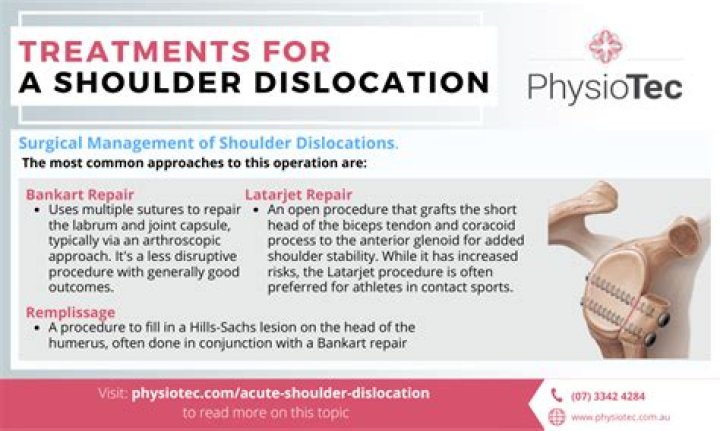 What is the best treatment for shoulder dislocation?