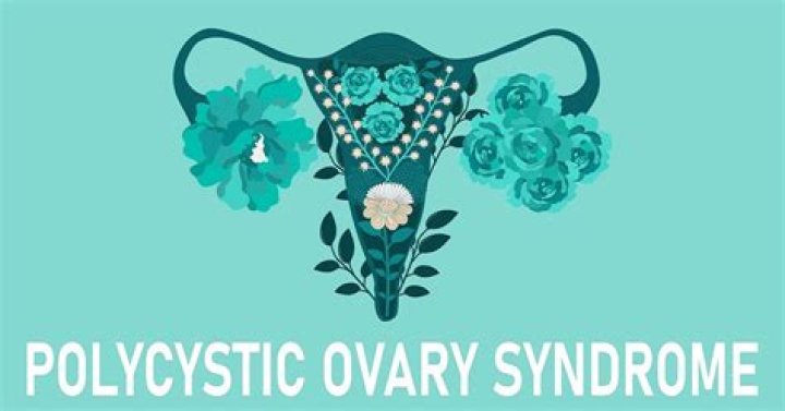 What is the fastest way to cure PCOS?