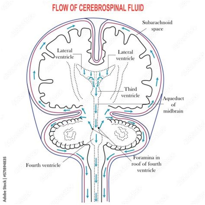 What is the normal amount of cerebral spinal fluid produced in the body in a day?
