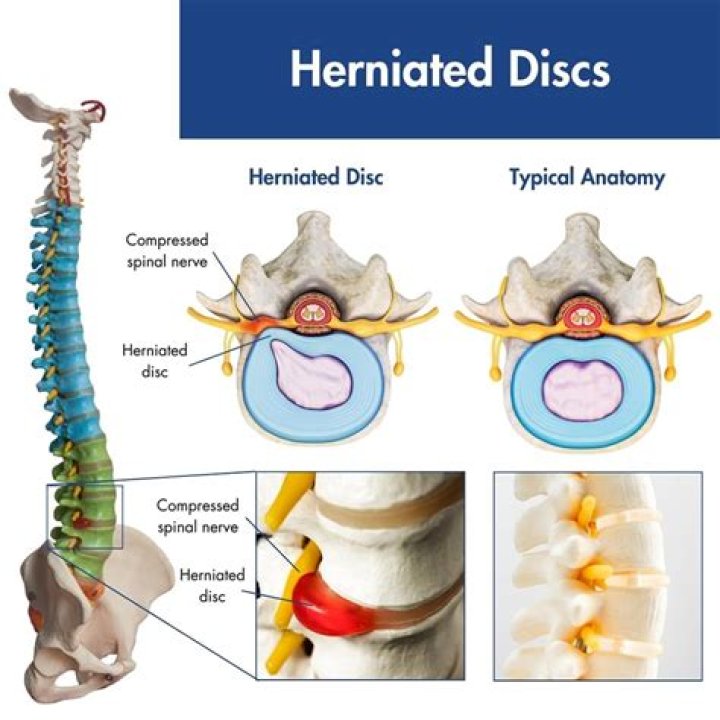 Where do you place disc so that computer could read?