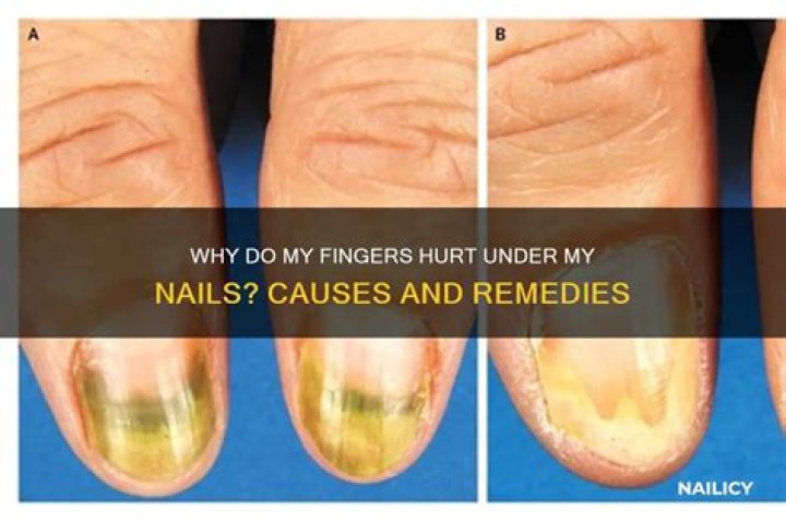 Why do my fingers hurt under my nails?